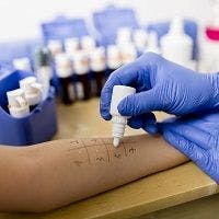 Incidence of the Deadliest Skin Cancer on the Rise