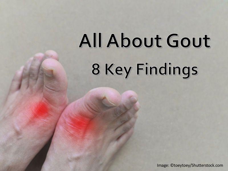 All About Gout: 8 Key Findings