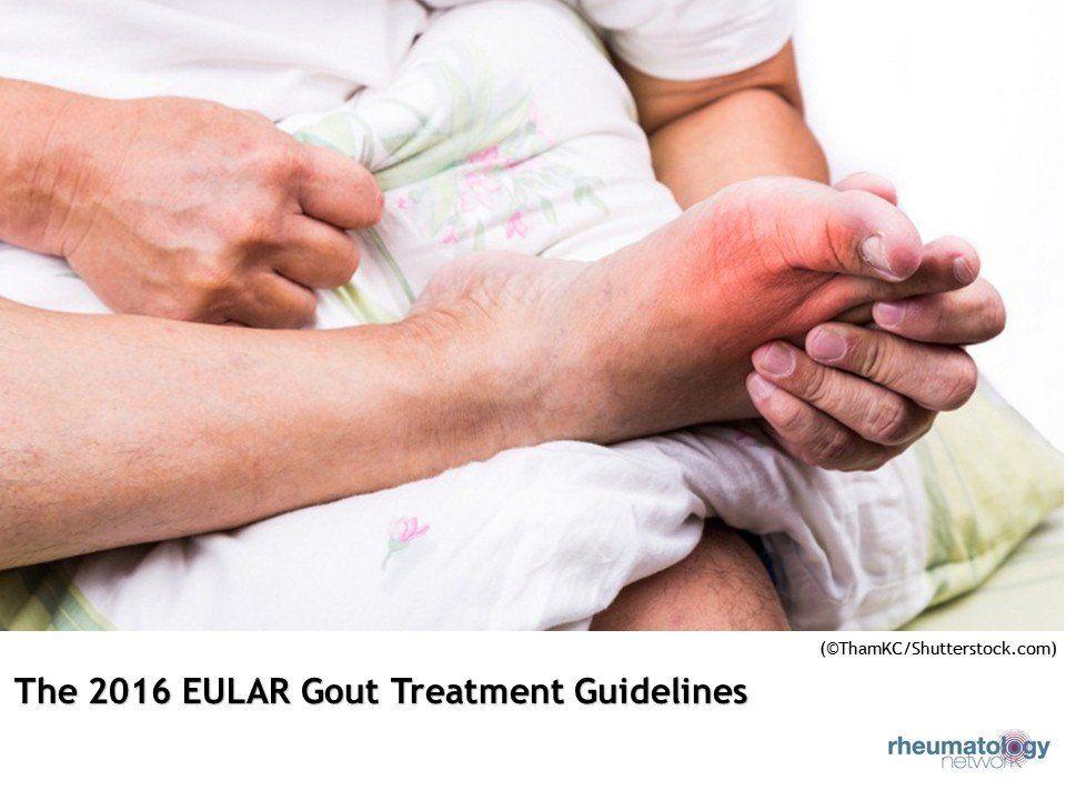 EULAR Recommends Treatment for Acute Gout at "First Warning"