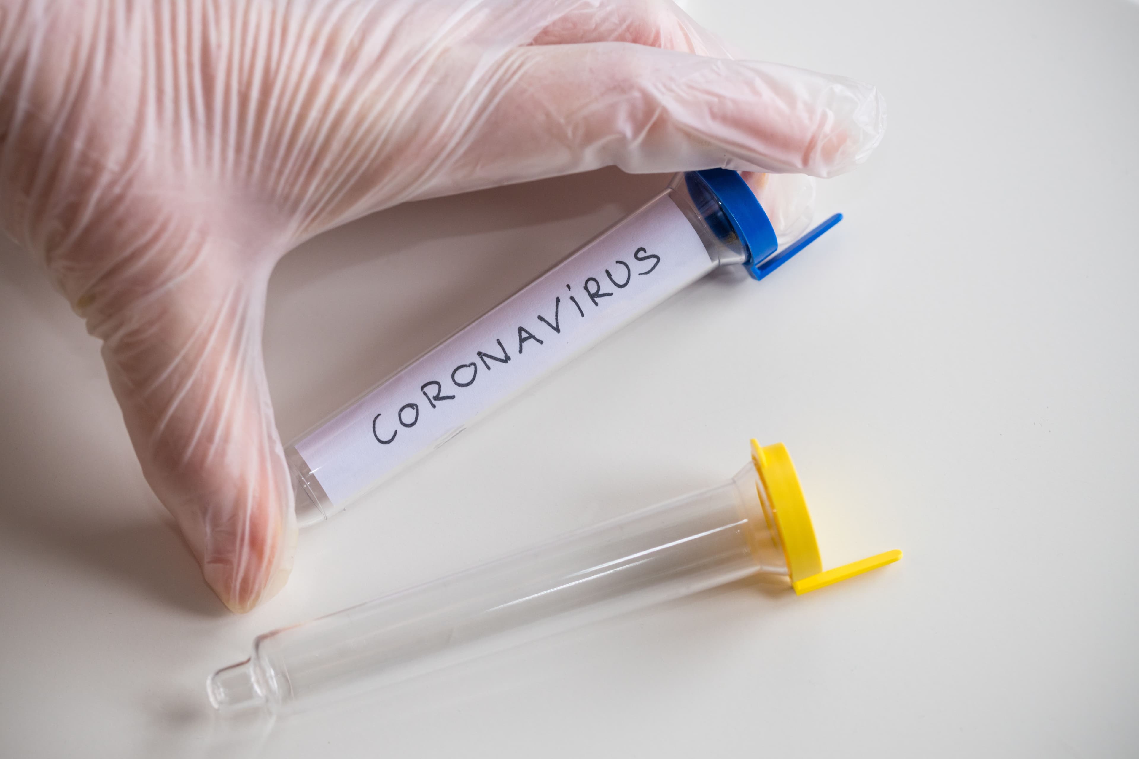 Coronavirus as Risk Factor for Rheumatoid Arthritis