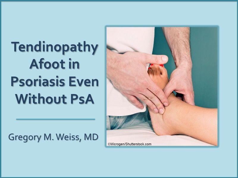 Tendinopathy Afoot in Psoriasis Even without PsA