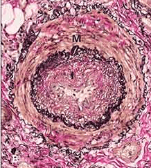 Systemic Sclerosis (Also) Discriminates on Basis of Ethnicity