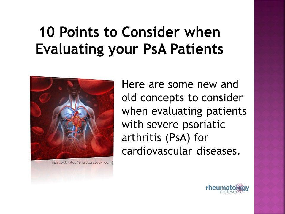 10 Points to Consider when Evaluating your PsA Patients