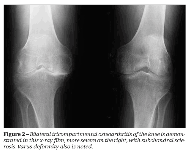 7 Osteoarthritis Imaging Recommendations