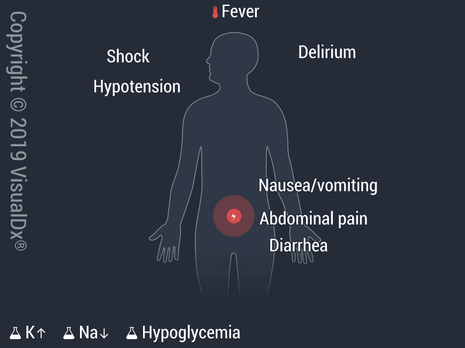 Image IQ: 70-Year-Old Woman with Abdominal Pain and Nausea