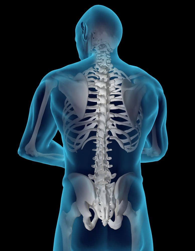 Does Fibromyalgia Mask Spondyloarthritis?