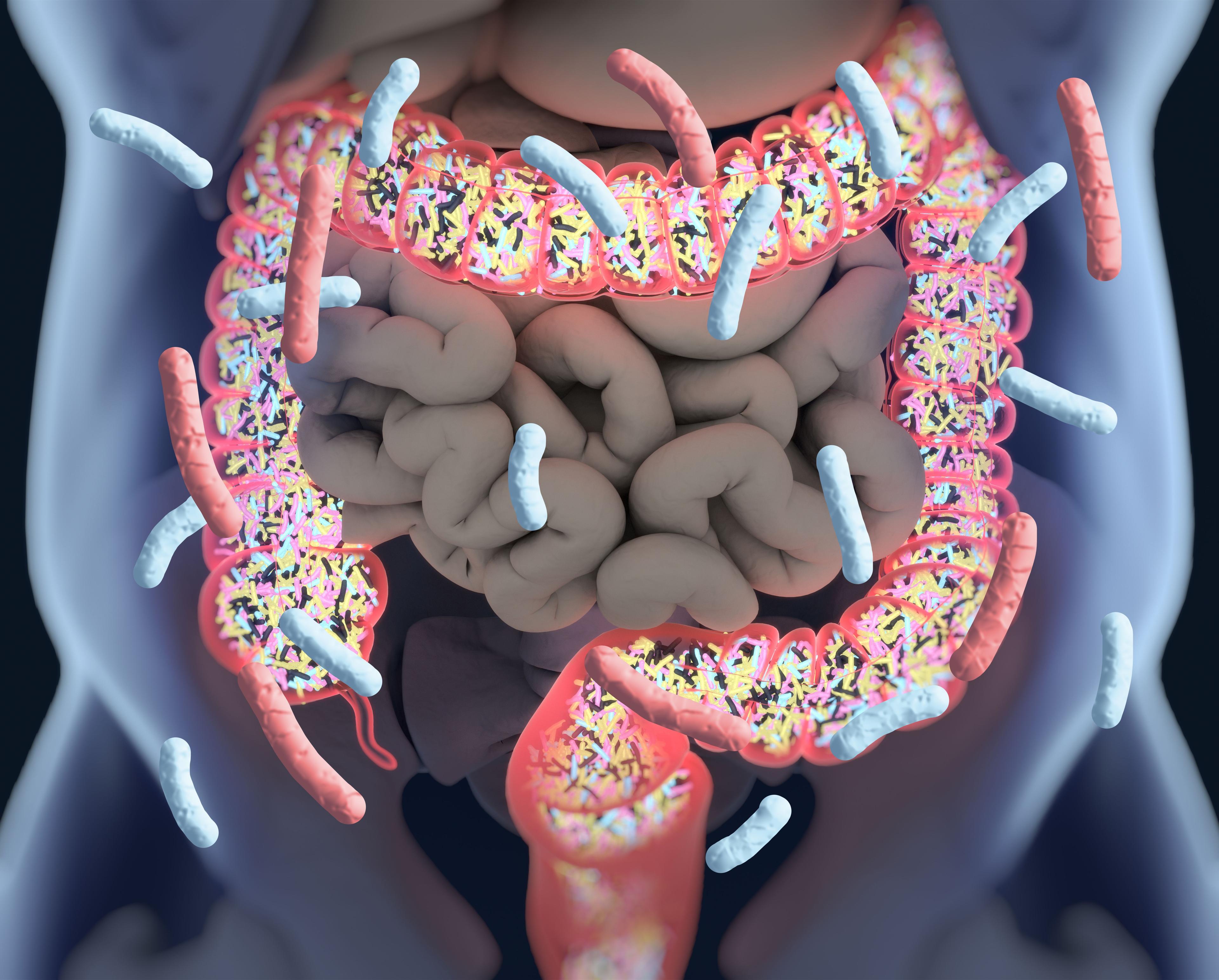 Impaired Microbiota May Lead to Spondyloarthritis