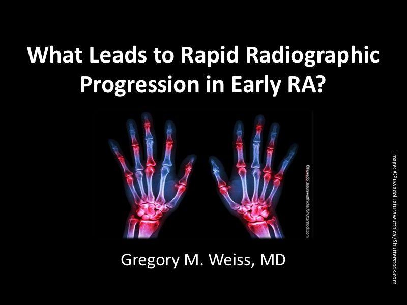 What Leads to Rapid Radiographic Progression in Early RA?