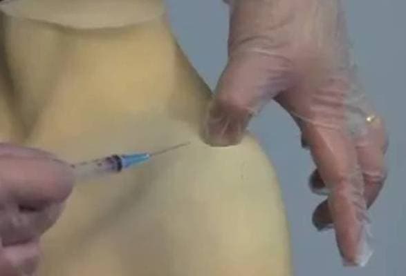 Injection Into the Acromioclavicular Joint