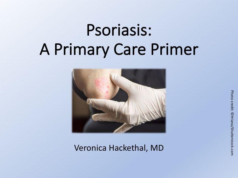 Psoriasis: A Primary Care Primer