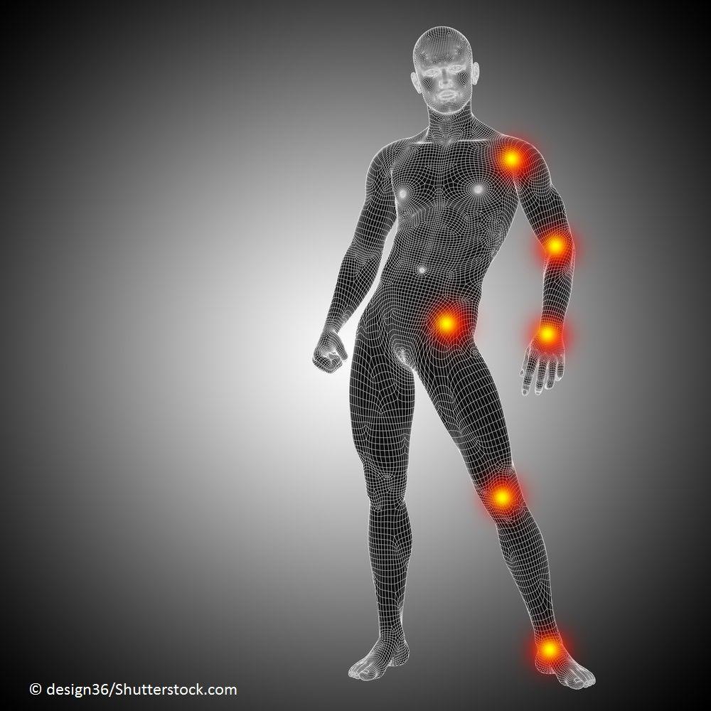 Filgotinib Monotherapy for Rheumatoid Arthritis